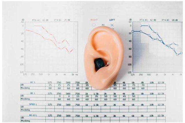 Fonoaudiologo/a para audiometrías